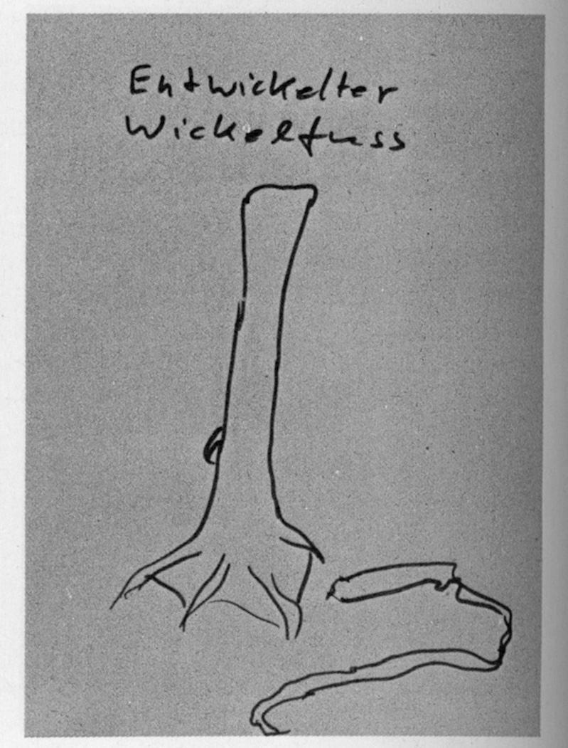 Begleitheft, S. 11, Bild: Entwickelter Wickelfuss.