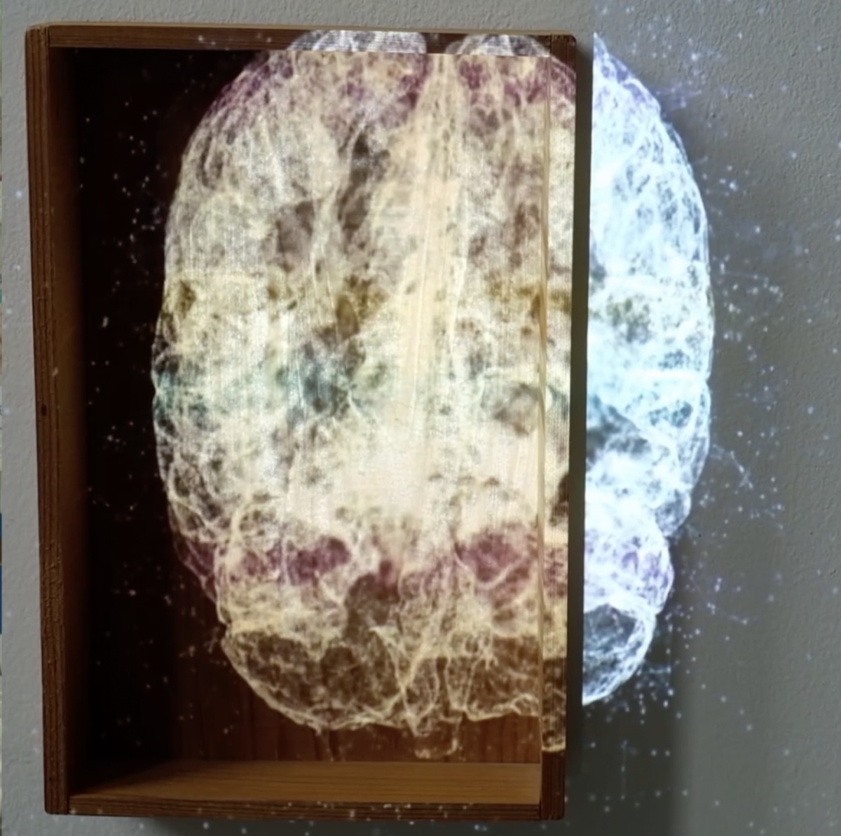 Montage: Gehirn über Beuys' Intutionskiste. Ausschnitt aus Video von Jürgen Grölle